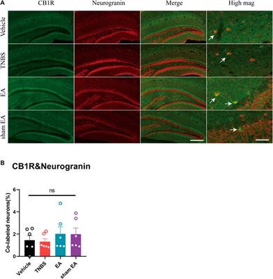 Electroacupuncture Reduces Anxiety Associated With Inflammatory Bowel Disease By Acting on Cannabinoid CB1 Receptors in the Ventral Hippocampus in Mice